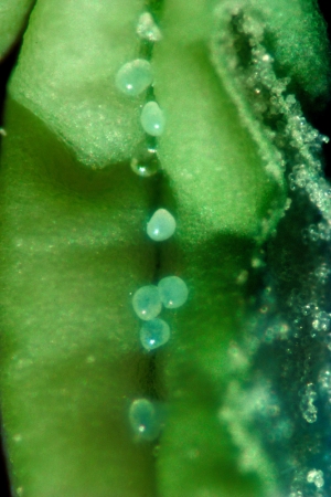 <strong>Mel Frank</strong><br /> <i>Anther, Resin Glands Center - Pollen Slit Right, Photomicrograph X40</i>, 1979<br /> Edition of 10<br /> Archival pigment print<br /> 20 x 13 inches